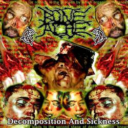 Boneache : Decomposition and Sickness
